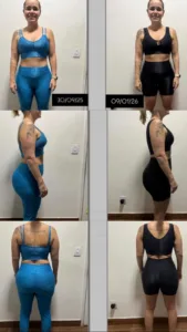 A IMPORTÂNCIA DA ATIVIDADE FÍSICA: MAIS DO QUE CORPO, É QUALIDADE DE VIDA 7 WhatsApp Image 2026 04 14 at 18.37.56